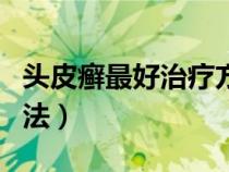 頭皮癬最好治療方法圖片（頭皮癬最好治療方法）