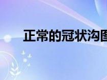 正常的冠狀溝圖片（正常冠狀溝圖片）