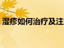 濕疹如何治療及注意事項（濕疹是如何治療）