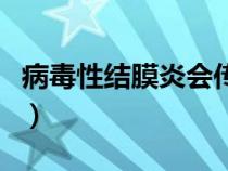 病毒性結(jié)膜炎會(huì)傳染給別人嗎（病毒性結(jié)膜炎）
