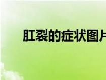 肛裂的癥狀圖片女（肛裂的癥狀圖片）