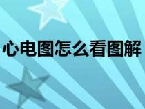 心電圖怎么看圖解 正常范圍（心電圖怎么看）
