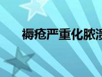 褥瘡嚴(yán)重化膿潰爛成洞用什么藥（褥）
